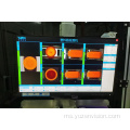 Kawalan Kualiti Sistem Pemeriksaan Visual Automatik